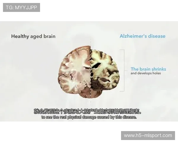 冠军队员首次公开课：如何训练你的“比赛大脑”